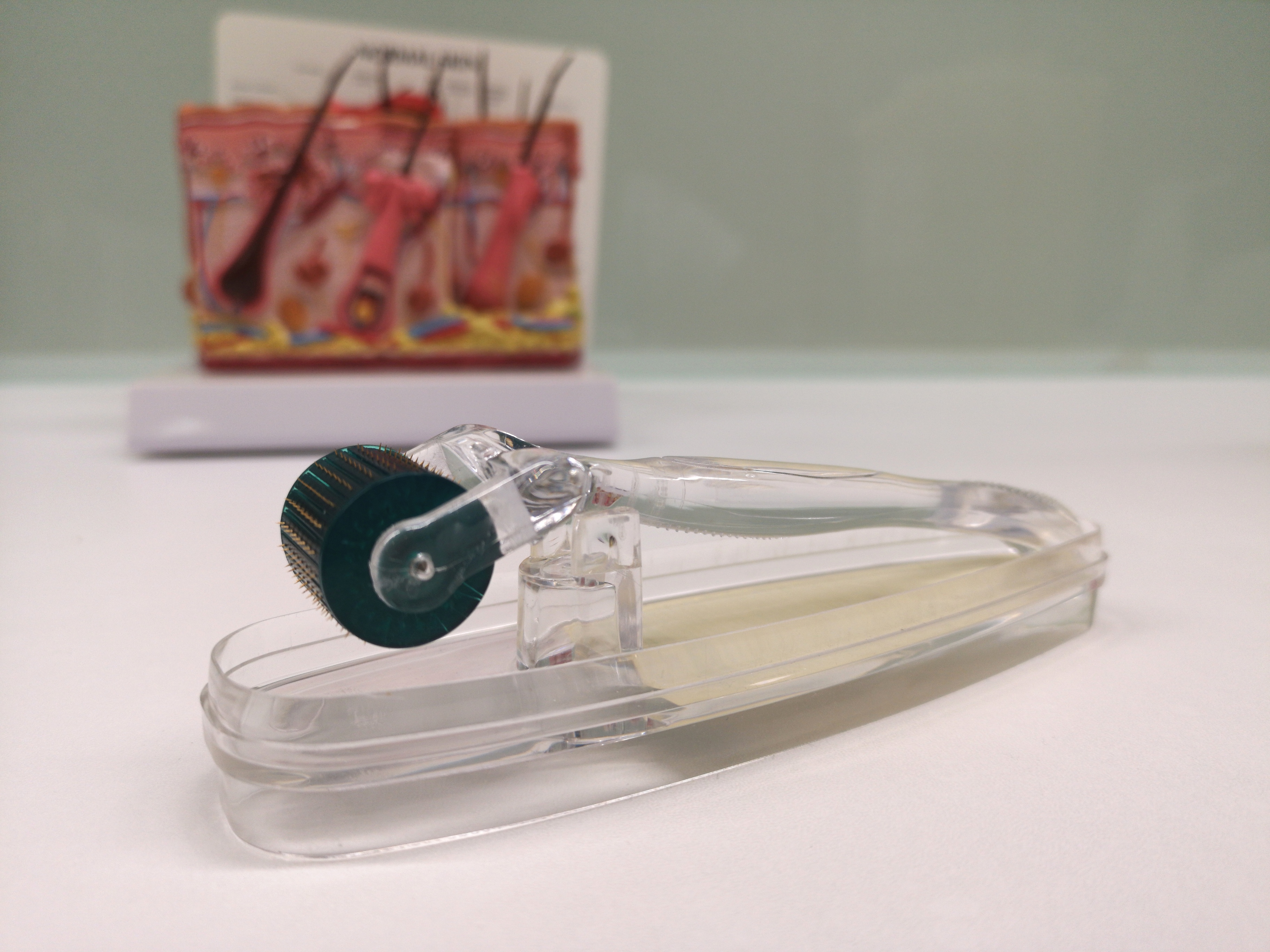 dermaroller haaruitval