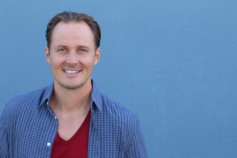 dunner haar, haaruitval, haarverlies, dun haar, haaruitval bij mannen, haaruitval bij vrouwen, behandelingen haaruitval, behandelingen haarverlies, natuurproducten, natuurlijke haarproducten